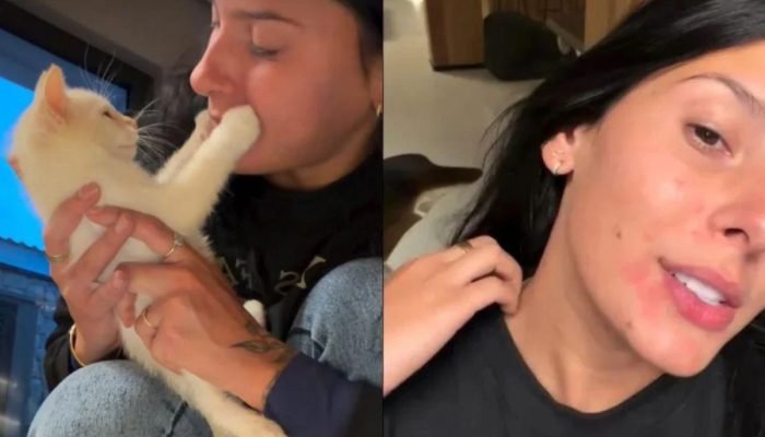 1 de 1 Alergia a pets: o que fazer? Caso de Ana Castela chama atenção - Foto: Instagram/Reprodu...